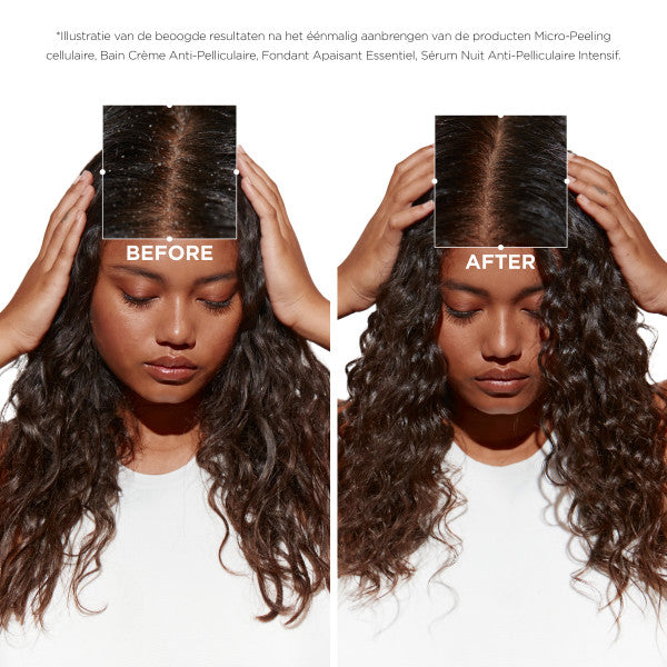 Kerastase Symbiose Hydrating Anti-Dandruff Shampoo before &amp; after